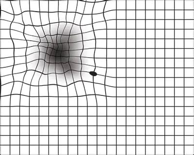 amsler grid distortion images.